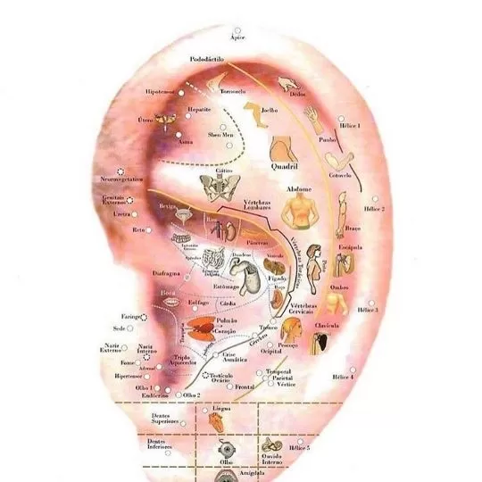 Auriculoterapia